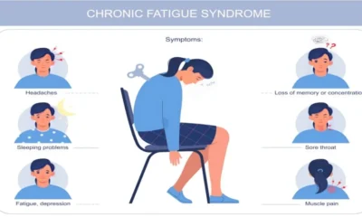 Chronic Fatigue Syndrome