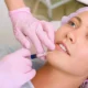 Dermal Fillers