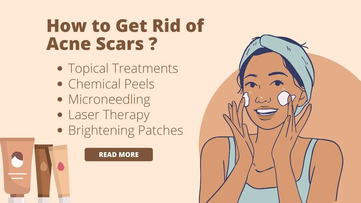 How to Get Rid of Acne Scars